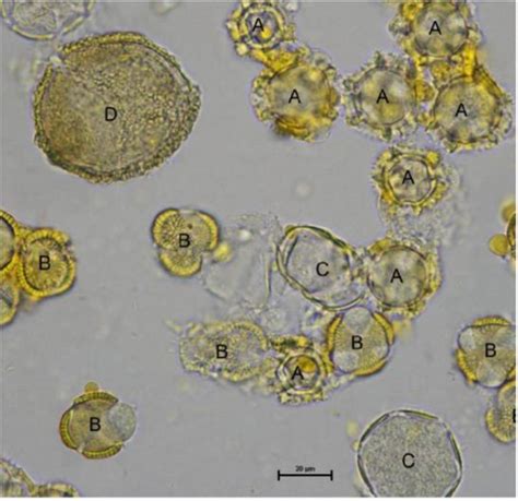 Example For The Analysis Of Pollen Types By Light Microscopy The Download Scientific Diagram