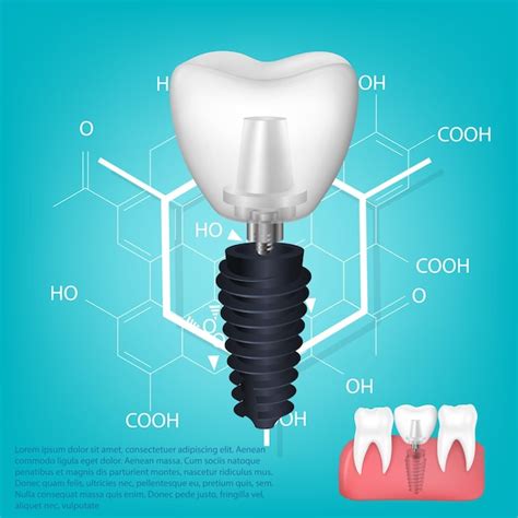 Premium Vector Vector Realistic Tooth Structural Elements Of A Dental