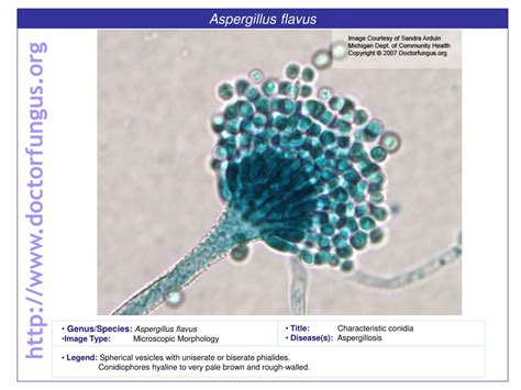 PPT - Aspergillus flavus PowerPoint Presentation, free download - ID:1699676