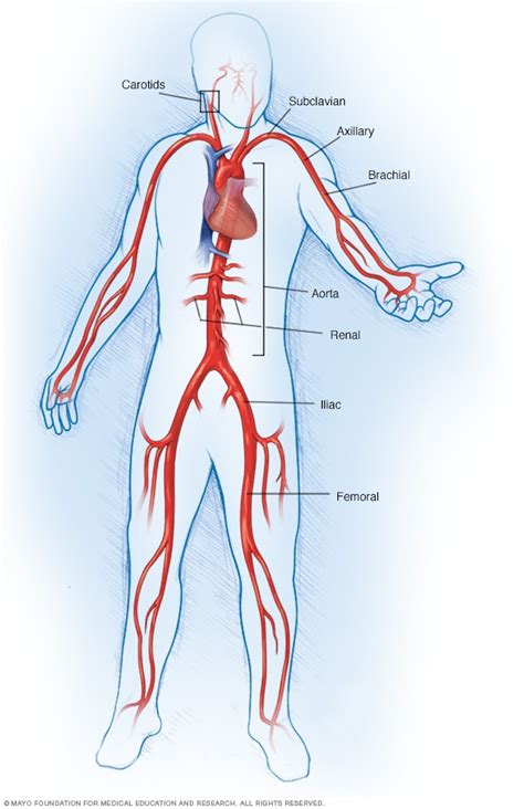 Takayasu's arteritis - Symptoms and causes - Mayo Clinic