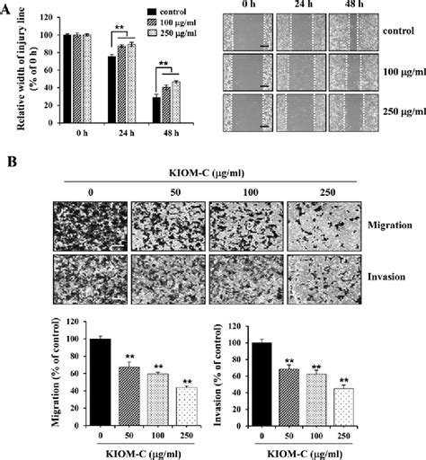 Figure 2 From Suppression Of The Invasive Potential Of Highly Malignant