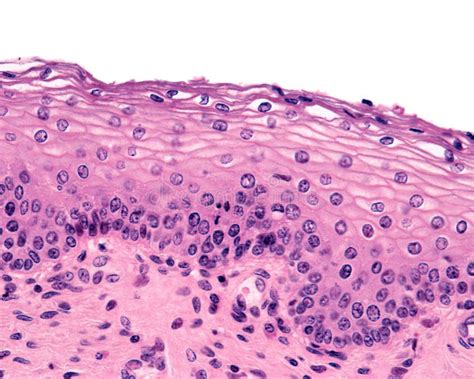 Vagina Stratified Aquamous Epithelium Stock Image Image Of Squamous Epithelial 231621221