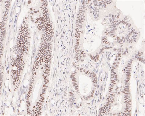 PMS2 Rabbit MAb SAB Signalway Antibody