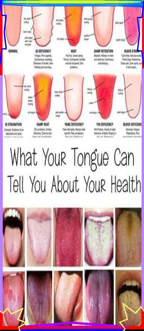 Awesome 47 Tongue Health Healthy Tongue Health Tips