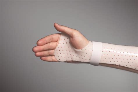 CE ISO Qualified Factory Direct Medical Wrist Hand Arm Thermoplastic