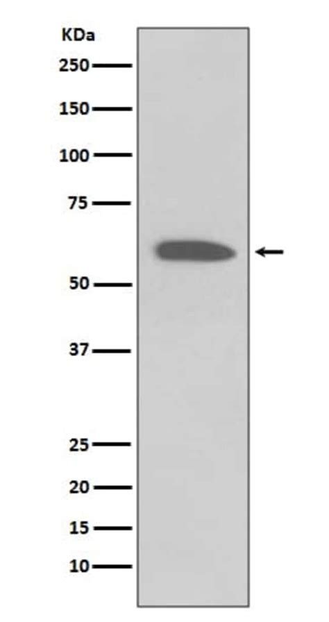 Akt P Ser473 Antibody Sr2061 Novus Biologicals 100 μg Unconjugated