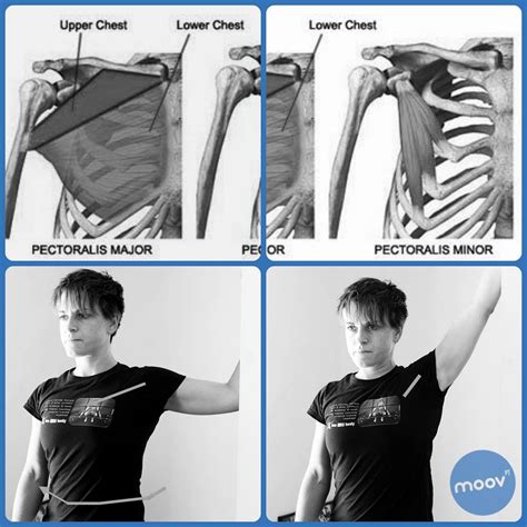 Undo Your Rounded Shoulders — Moov Personal Training