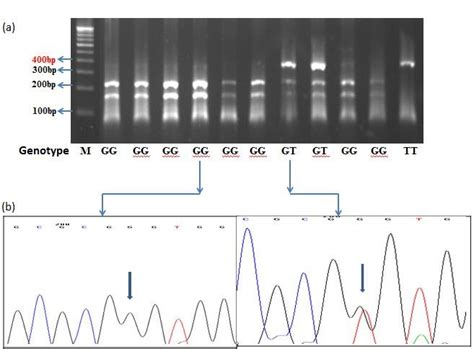 Genotyping Of Snp Rs242941 By Pcr Rflp A Agarose Gel Download