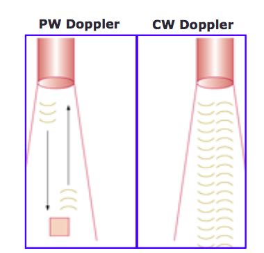 Unit 4 Session 16 CV Principles Continuous Wave Doppler Flashcards