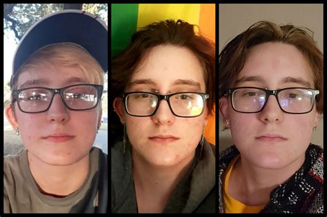 Pre T Vs 3 Months Vs 5 Months R Transtimelines