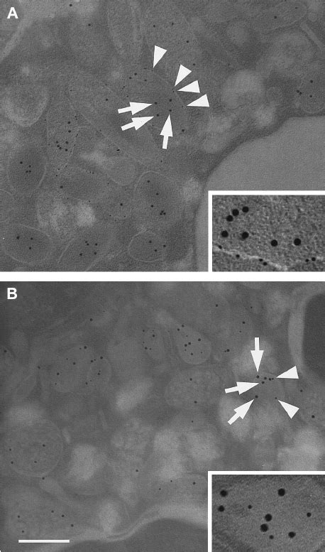 Subcellular Localization Of HBP By Electron Microscopy Neutrophils