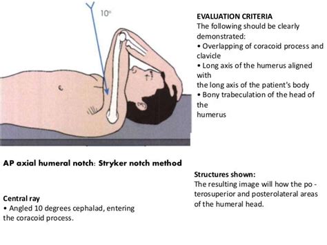 Shoulder Girdle Presentation