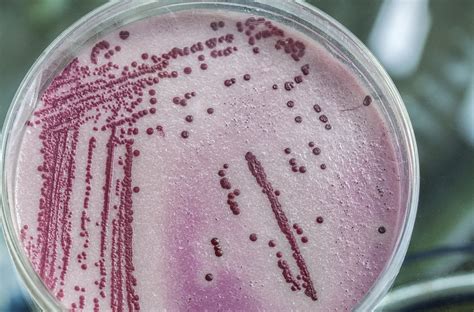 Las Bacterias M S Peligrosas Consumer