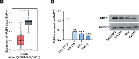 Lncrna Nr2f1 As1 Inhibits The Malignant Properties Of Cervical Cancer