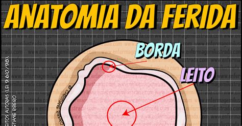 Tipos De Borda De Ferida Retoedu