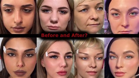 Power Of The Plastic Surgery YouTube