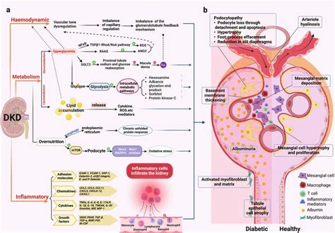 Pathology Of The Glomerulus And Tubules In Dkd A The Classical