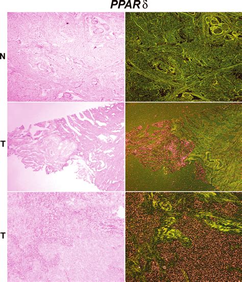 In Situ Hybridization Of Ppar Mrna In Normal Tissue N And Uterine