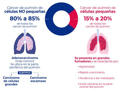 Tipos de Cáncer de Pulmón Clínica Ciudad del Mar