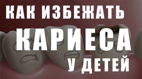 Кариес у детей. Кариес молочных зубов. Профилактика кариеса - YouTube