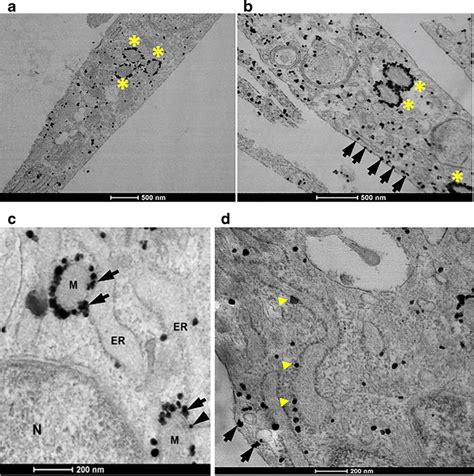 Immuno Gold Electron Microscopy Of Tspo In Primary Microglia A