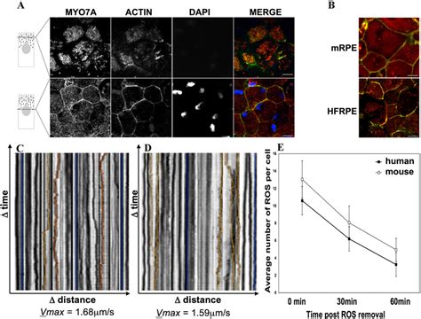 Myo A In Cultured Human Fetal Rpe Cells And Comparison With Primary