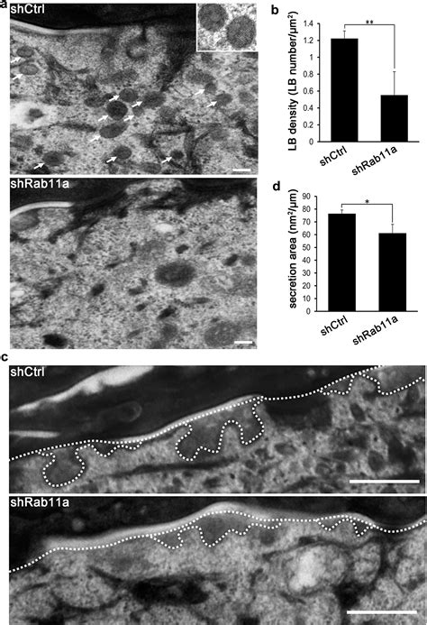 Rab A Is Essential For Lamellar Body Biogenesis In The Human Epidermis