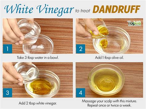 Home Remedies for Dandruff | Top 10 Home Remedies