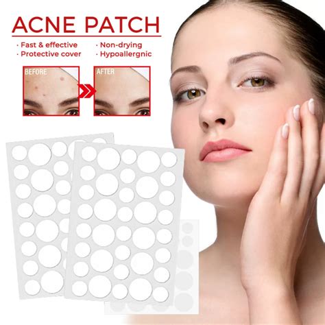 Pcs Sheet Acne Pimple Patch Salicylic Acid Acne Treatment Stickers