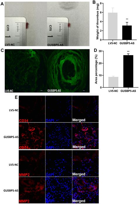 LncRNA GUSBP5 AS Promotes EPC Migration And Angiogenesis And Deep Vein