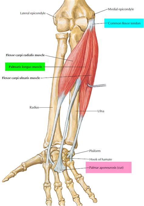 Dupuytren's Contracture - Causes, Symptoms, Treatment