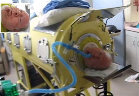 Man Who S Lived Inside Iron Lung For Over 65 Years Had To 44 Off