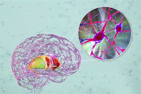 Dorsal Striatum In The Brain And Closeup View Of Its Neurons 3D