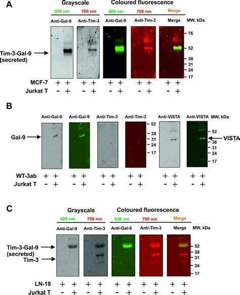 T Lymphocytes Induce Human Cancer Cells Derived From Solid Malignant