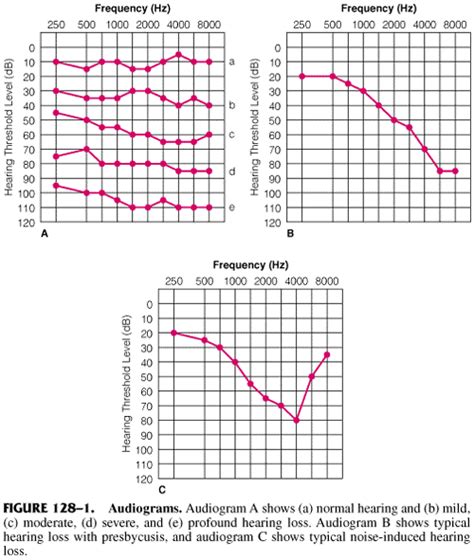 Aural Rehabilitation — Hear Md