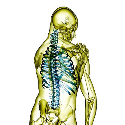 La Scoliosi E Il Busto Ortopedico Fisioplant