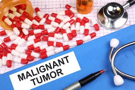 Free of Charge Creative Commons malignant tumor Image - Medical 5