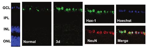 Changes In Expression And Distribution Of Hax Visualized By