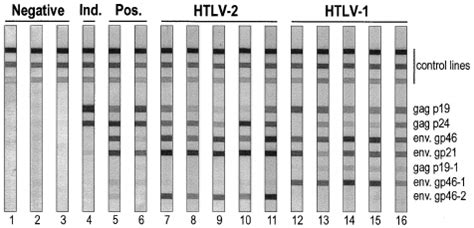 Layout Of The Inno Lia Htlv Strips The Antigen Lines Are Pared To