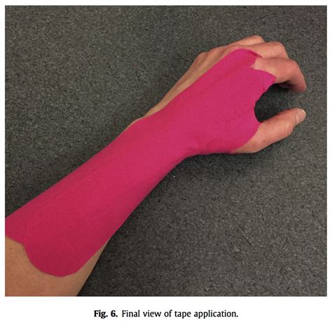 Two Ways To Tape The Wrist Rigid Tape And Kinesiology Tape