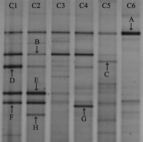 Denaturing Gradient Gel Electrophoresis Dgge Analysis Of Pcr Download Scientific Diagram