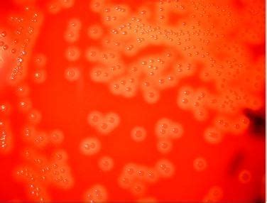 Blood Agar And Types Of Hemolysis Microbe Online