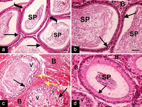 Hande Stained Sections From Rat Epididymis Display A The Control Group