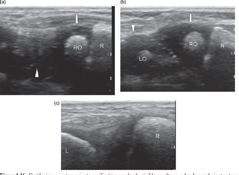 Figure From Musculoskeletal Ultrasound Anatomy And Technique