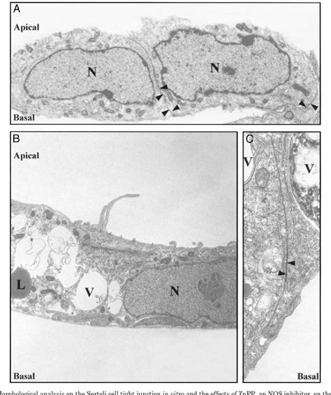 Figure From Regulation Of Sertoli Cell Tight Junction Dynamics In The