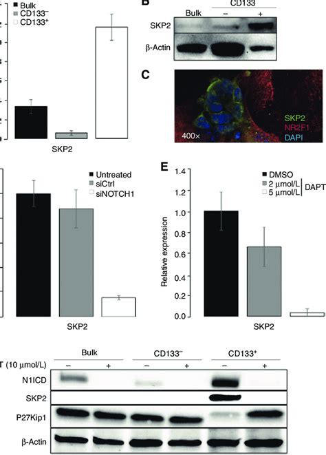 Cd133 þ Cell Selective And Notch1dependent Skp2 Expression In Acc