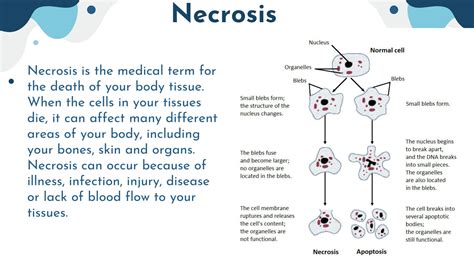 Solution Types Of Necrosis 4 Studypool