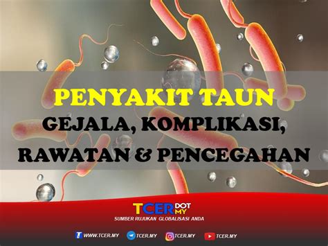 penyakit taun gejalakomplikasi rawatan   pencegahan tcermy