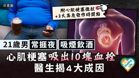 心臟健康︳21歲男常捱夜吸煙飲酒 心肌梗塞吸出10塊血栓 醫生揭4大成因 晴報 健康 心臟健康 D221006