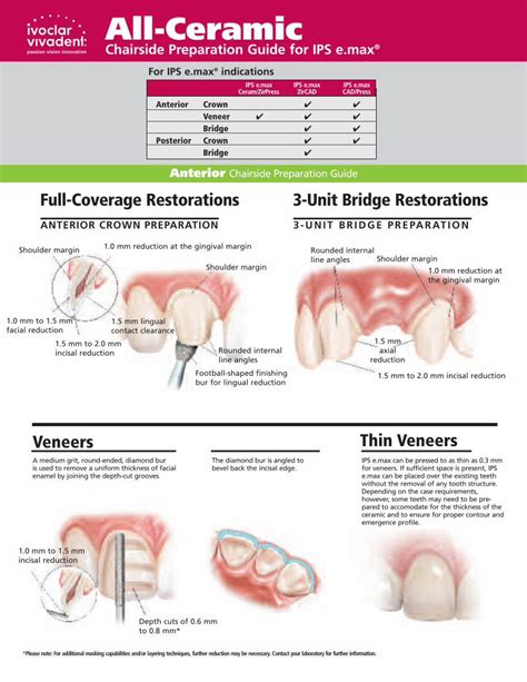 Pdf Emax Chairside Prep Guide Dental Ceglidewelldental